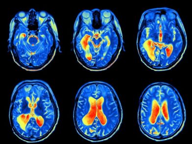 fmri_1136518-860x643.jpg